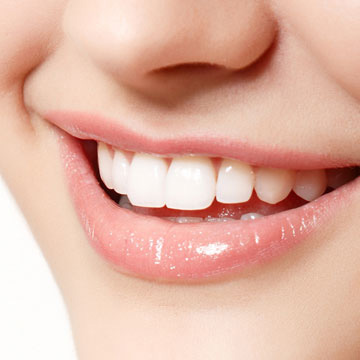 Tooth Whitening