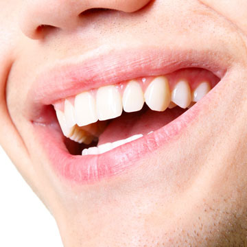 Retainers