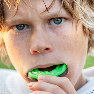 Pro-laminated layer Mouthguards